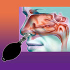 CFR: Cranial Facial Release